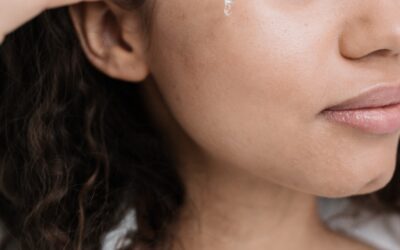 Benefits for Skin: How Does CBD Treat Skin Problems?